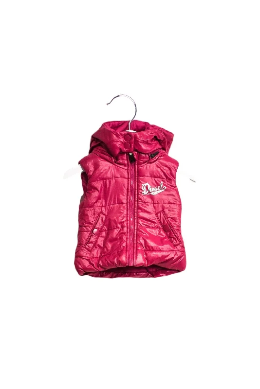 Diesel Puffer Vest 6M (Detachable Hood)